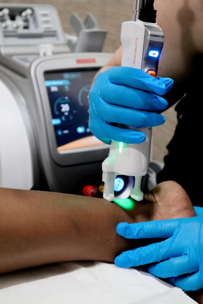 zenbar laser hair renewal darker skin