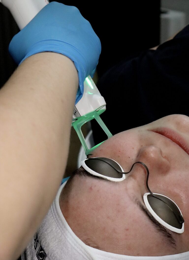 zenbar laser facial