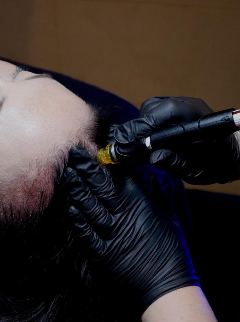 Hydrafacial Keravive Hair Renewal Treatment Scalp Boost - Zenbar Healing Studio