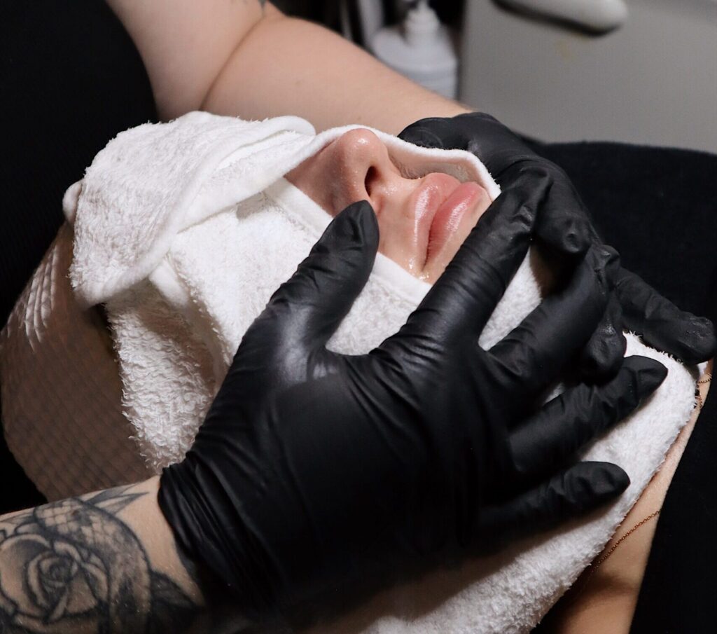 zenbar peel & reveal event / medical facials chemical peel