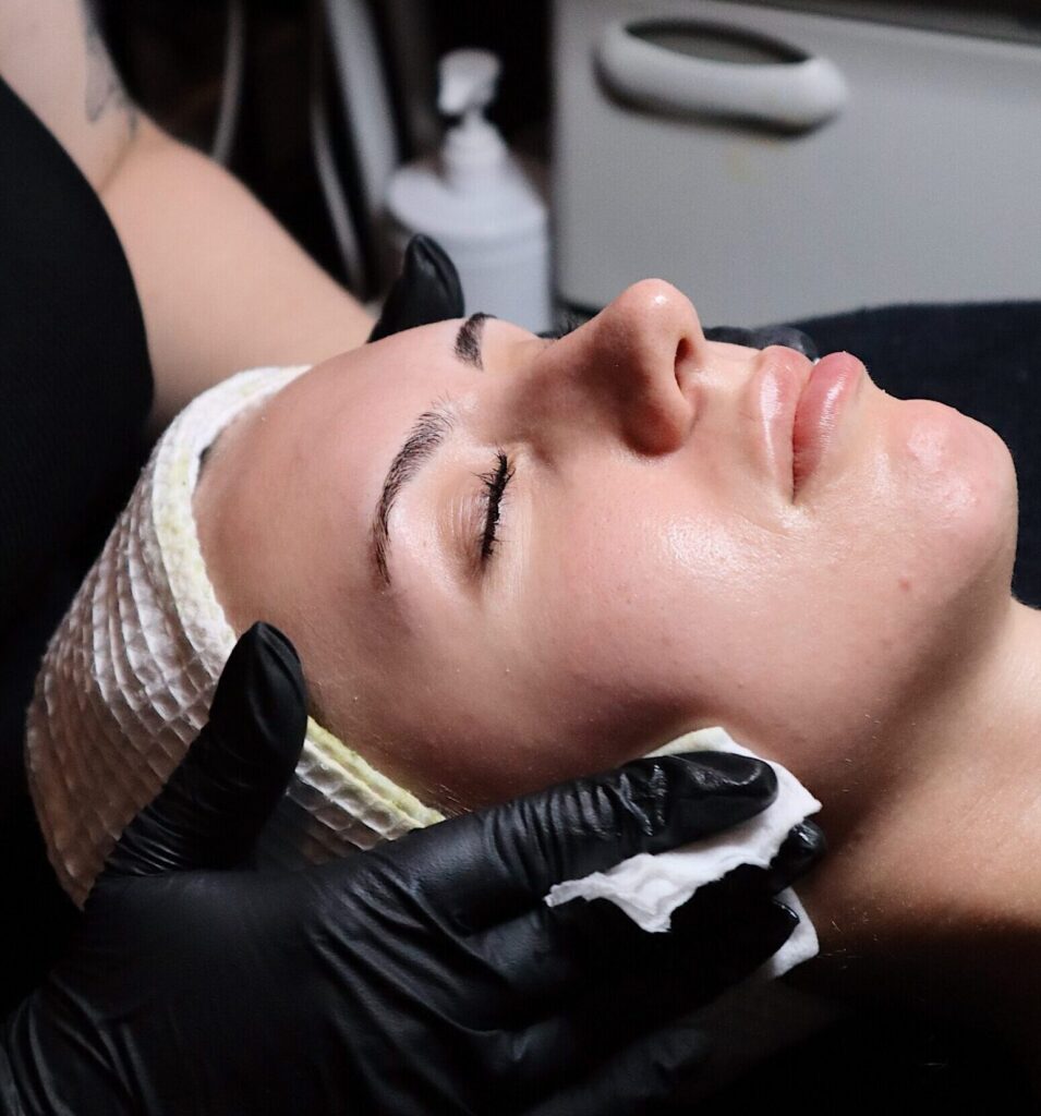 zenbar peel & reveal event / medical facials chemical peel