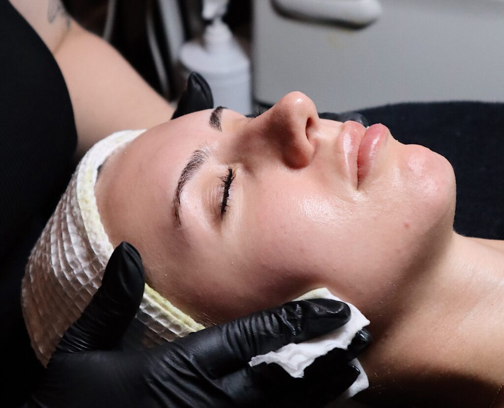 zenbar peel & reveal event / medical facials chemical peel
