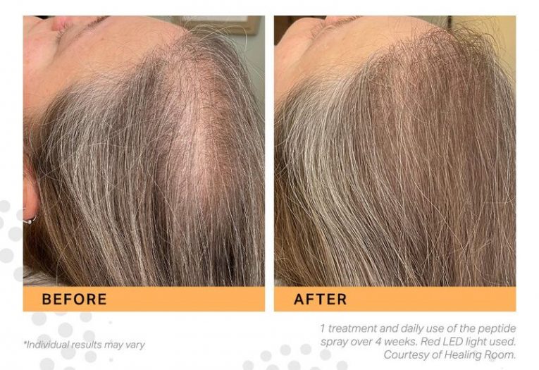 zenbar keravive results