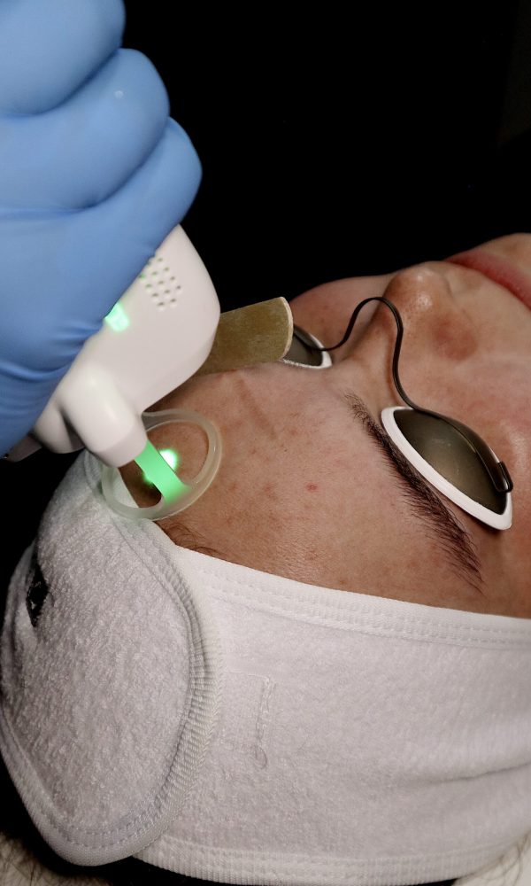 zenbar laser facial / medical facials