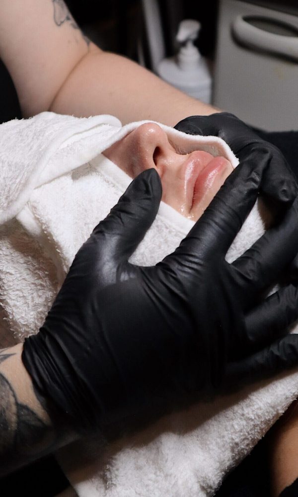 zenbar peel & reveal event / medical facials chemical peel
