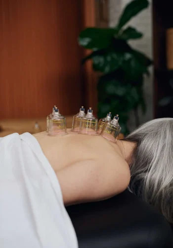 Mobile+acupuncture+cupping+vancouver+burnaby