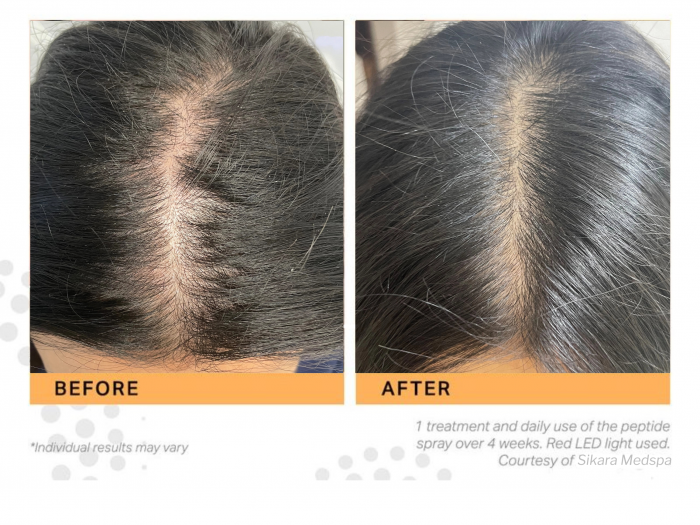 zenbar keravive results