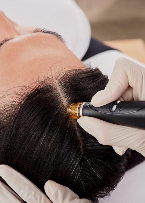Hydrafacial Keravive Hair Renewal Treatment - Zenbar Healing Studio