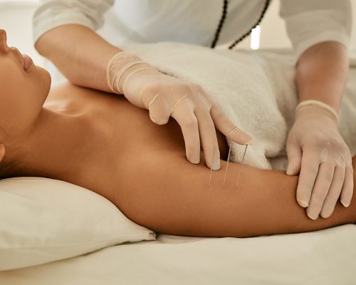 Zenbar Healing Studio - Body Acupuncture - Oakville Spa - Luxury Day Spa